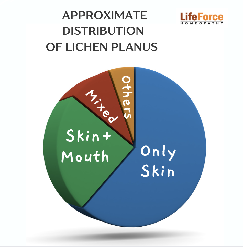 Lichen planus areas affected